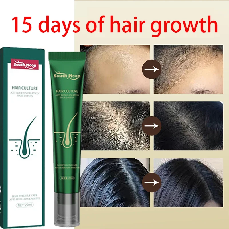 

Fast Hair Growth for Men Women Hair Oil Care Ginger Anti Hair Loss Scalp Treatment Grow Serum Products Beauty Health