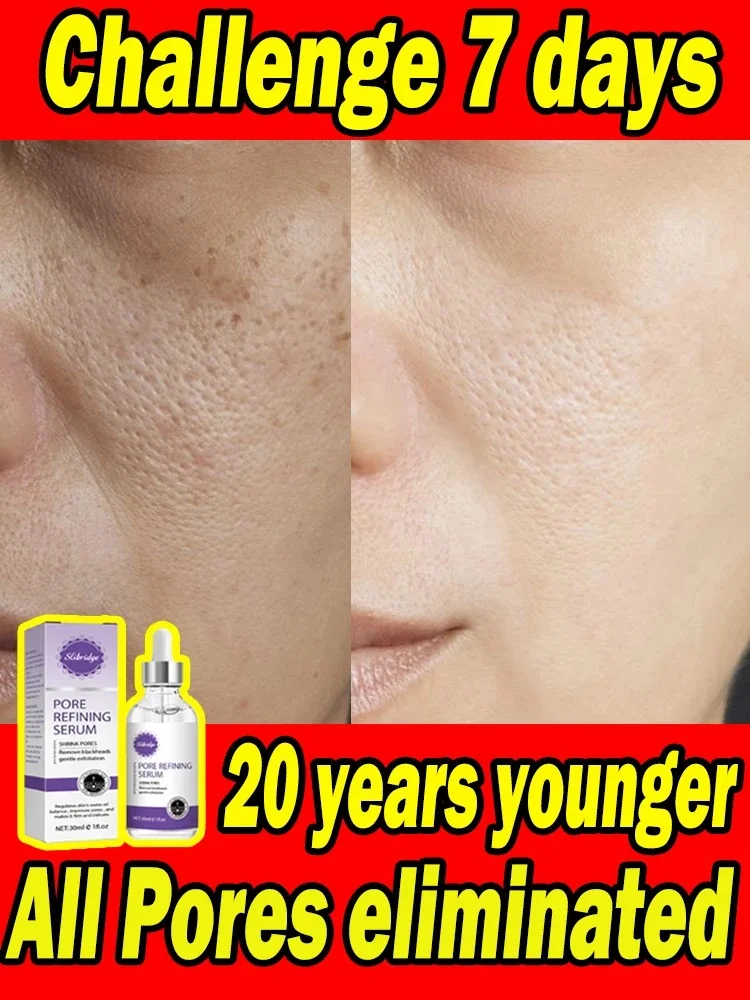 Facial Pore Shrinking Serum Repair Remove Blackheads Acne Skin Care Facial Pore Shrinking Serum Wet Soothing Brightening Repair
Facial Pore Shrinking Serum Repair Remove Blackheads Acne Skin Care Facial Pore Shrinking Serum Wet Soothing Brightening Repair