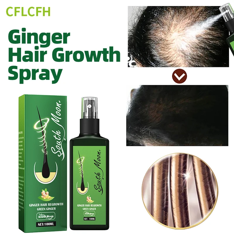 Hair Growth Spray For Men And Women Scalp Hair Regrowth Care Anti Hair Loss Treatment Products Essential Oils Ginger Cream 100Ml
Hair Growth Spray For Men And Women Scalp Hair Regrowth Care Anti Hair Loss Treatment Products Essential Oils Ginger Cream 100Ml
