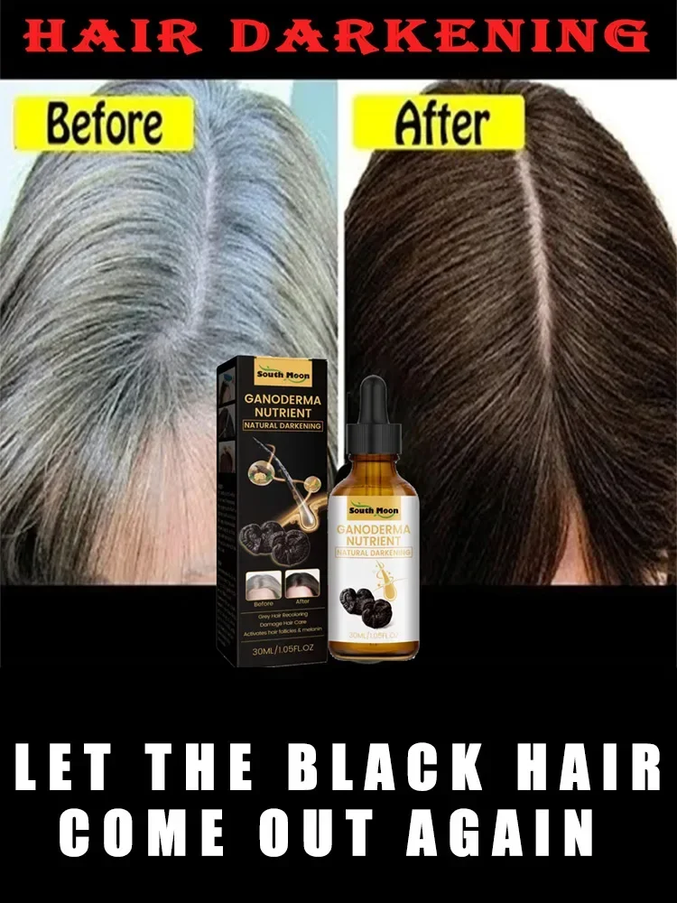 10PCS Gray White Hair Treatment Serum Liquid White To Black Natural Color Repair Nourish Product Anti Loss Hair Care Men Women
10PCS Gray White Hair Treatment Serum Liquid White To Black Natural Color Repair Nourish Product Anti Loss Hair Care Men Women