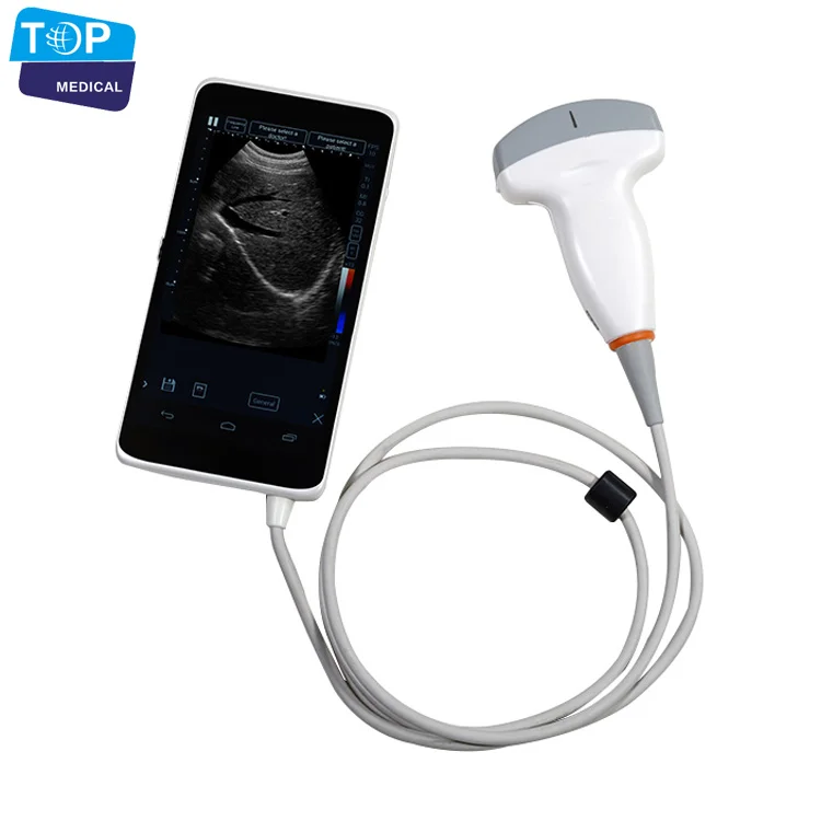 TOP-A1026 Wifi, Лучшая цена, Самая Дешевая портативная ультразвуковая система диагностики, сертификат CE,ISO, цветной Доплер
TOP-A1026 Wifi, Лучшая цена, Самая Дешевая портативная ультразвуковая система диагностики, сертификат CE,ISO, цветной Доплер