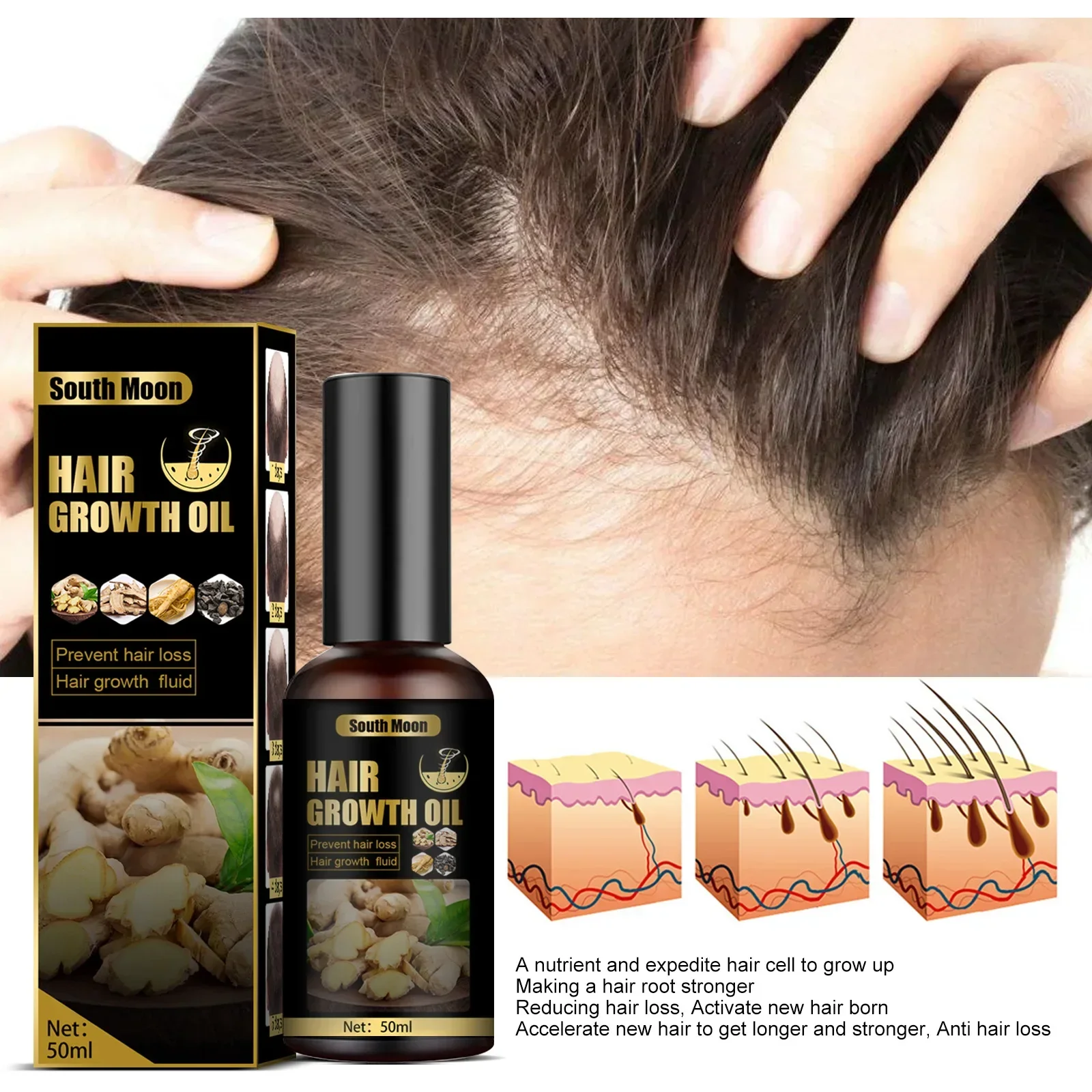 

Sdotter New Ginger Fast Hair Growth Essential Oil Natural Anti Hair Loss Prevent Baldness Treatment Fast Growing Nourish Dry Dam