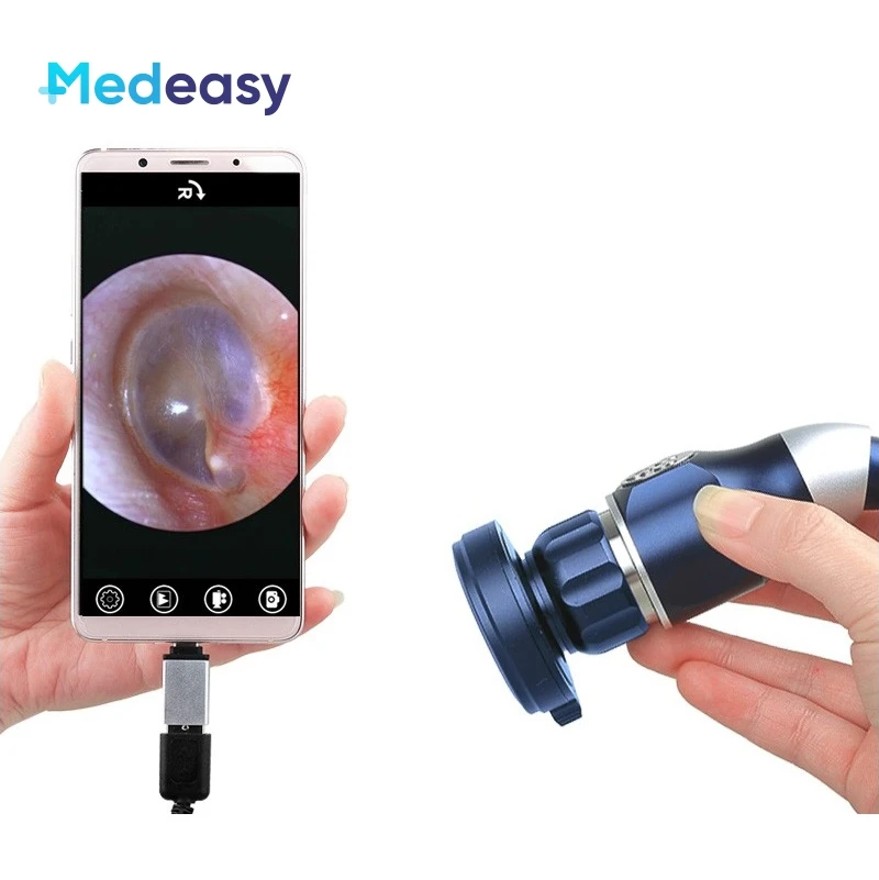 Medical USB endoscope camera for ENT surgery, waterproof portable endoscope camera
Medical USB endoscope camera for ENT surgery, waterproof portable endoscope camera