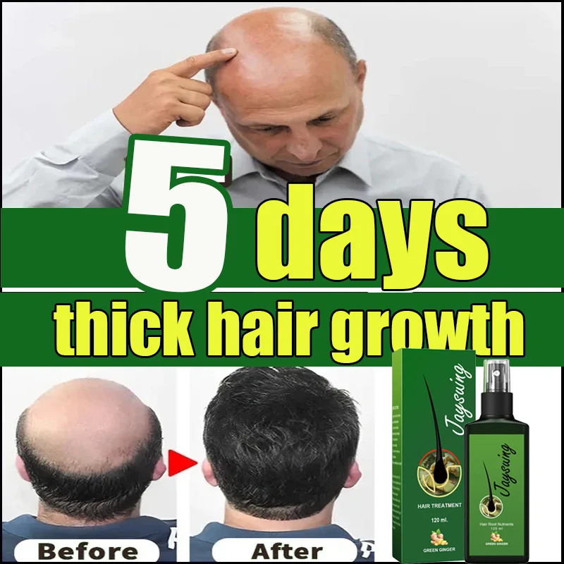 Natural Ginger Hair Growth Spray Hair Roots Fast Grow Prevent Hair Loss Baldness Treatment Dense Hair Beauty Hair Care Men Women
Natural Ginger Hair Growth Spray Hair Roots Fast Grow Prevent Hair Loss Baldness Treatment Dense Hair Beauty Hair Care Men Women