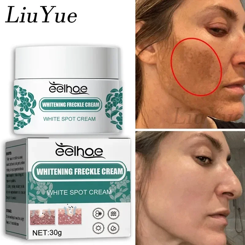 

Anti-aging Freckle Cream Whitening Remove Dark Spots Vitamin C Cream Dark Skin Brighten Serum Melasma Remover Korean Skin Care