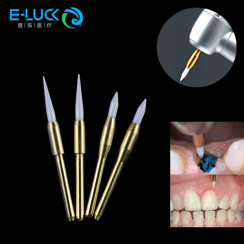 1pc Dental Soft Trimmer Burs Ceramic Soft Tissue Gingiva Trimmer Teeth Whitening Implant Tool For Dentist Product
1pc Dental Soft Trimmer Burs Ceramic Soft Tissue Gingiva Trimmer Teeth Whitening Implant Tool For Dentist Product