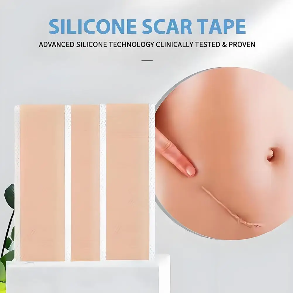 parche de Gel de silicona Lifting Facial para eliminar cicatrices, cinta de eliminación de cicatrices, Sección de quemaduras, cubierta de la piel, reparación de Trauma, oreja, acné, belleza, cicatriz, N8D7 9 parche de Gel de silicona Lifting Facial para eliminar cicatrices parche de Gel de silicona Lifting Facial para eliminar cicatrices, cinta de eliminación de cicatrices, Sección de quemaduras, cubierta de la piel, reparación de Trauma, oreja, acné, belleza, cicatriz, N8D7 » parche de Gel de silicona Lifting Facial para eliminar cicatrices