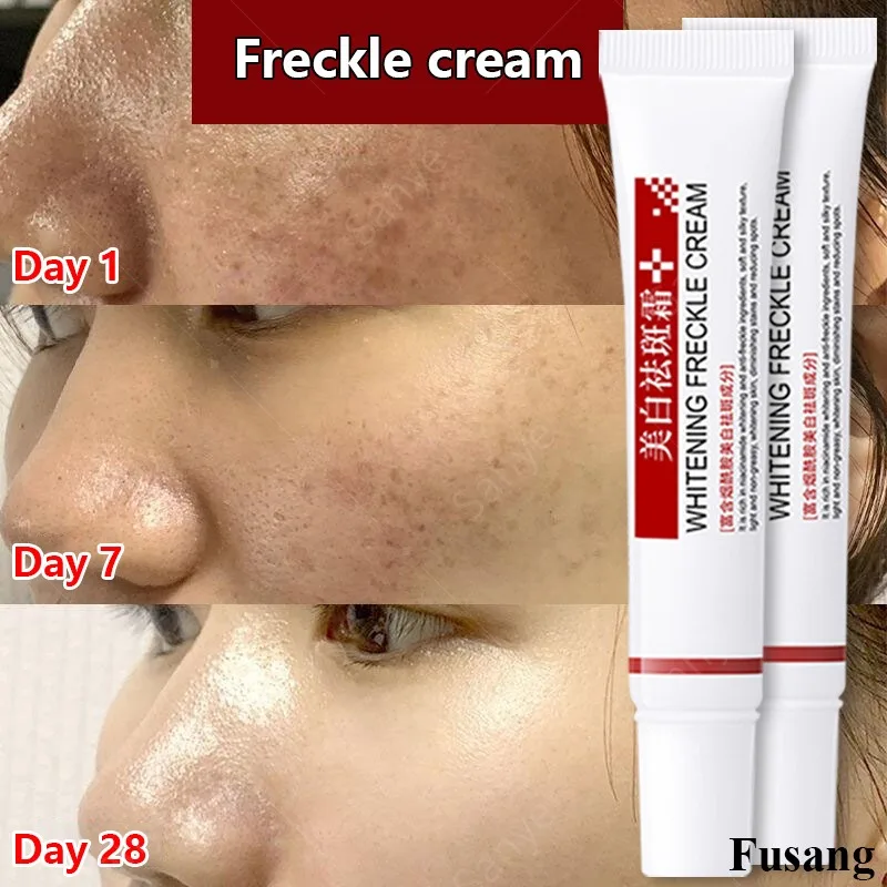 Niacinamide Face Freckles Cream for Women Remove Melasma Dark Spots Lotion Lighten Melanin Whitening Cream Skin Brightening Care
Niacinamide Face Freckles Cream for Women Remove Melasma Dark Spots Lotion Lighten Melanin Whitening Cream Skin Brightening Care