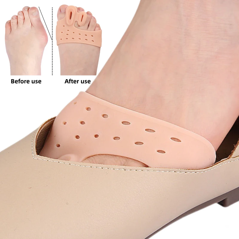 2pieces=1pair Gel Silicone Hallux Valgus Toe Splitter Forefoot Pad Big Foot Bone Orthopedic Insole Massage Forefoot Cushion
2pieces=1pair Gel Silicone Hallux Valgus Toe Splitter Forefoot Pad Big Foot Bone Orthopedic Insole Massage Forefoot Cushion