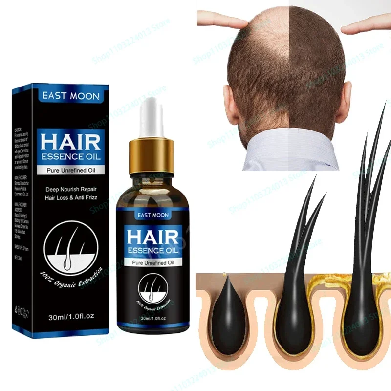

Sdottor Strong Effect Hair Growth Products Ginger Essential Oil 2 Week Treat Hair Loss Scalp Repair Nourish Hair Roots Regrowth