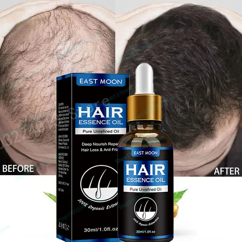 

Unisex Hair Growth Oil Hair Loss Treatment Rapid Hair Growth Effective Baldness Repair Stress Postpartum Scalp Damage