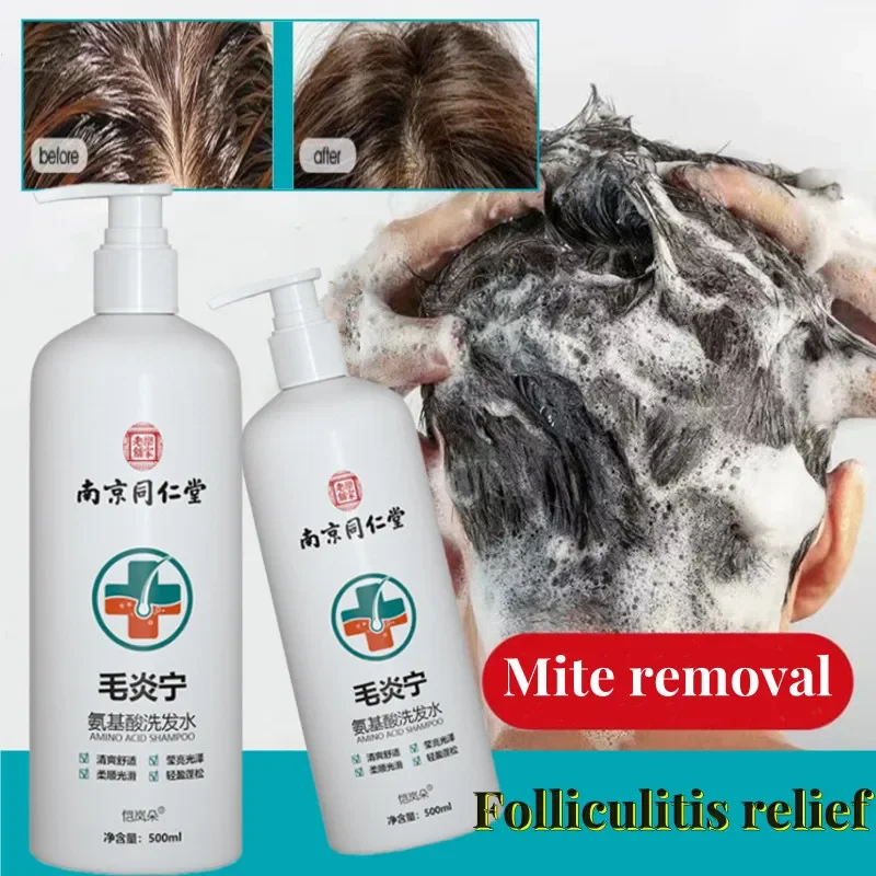 

Hair Inflammation Amino Acid Ning Shampoo Dew Repair Hair Follicle Plant Mite Removal Hair Cream Damage Repair Improve Frizz