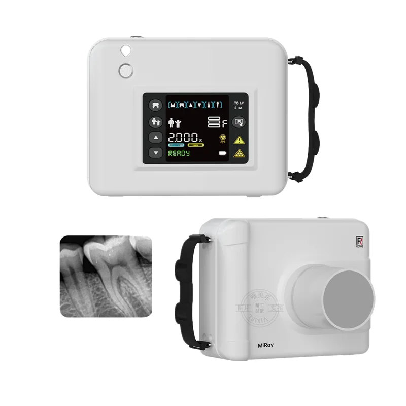 REFINE Portable X Ray MiRay Machine/den tal Portable Frequency X Ray Machine Digital den tal X-Ray Unit
REFINE Portable X Ray MiRay Machine/den tal Portable Frequency X Ray Machine Digital den tal X-Ray Unit