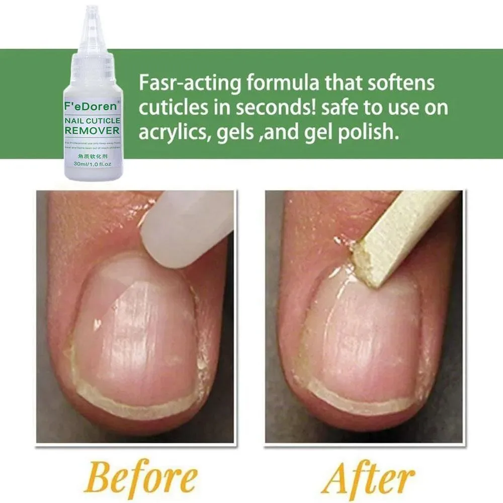 30ml Beauty And Health Soften Dead Skin Manicure Tools Exfoliation Nail Products Cuticle Solvent Nail Massage Cream 
30ml Beauty And Health Soften Dead Skin Manicure Tools Exfoliation Nail Products Cuticle Solvent Nail Massage Cream