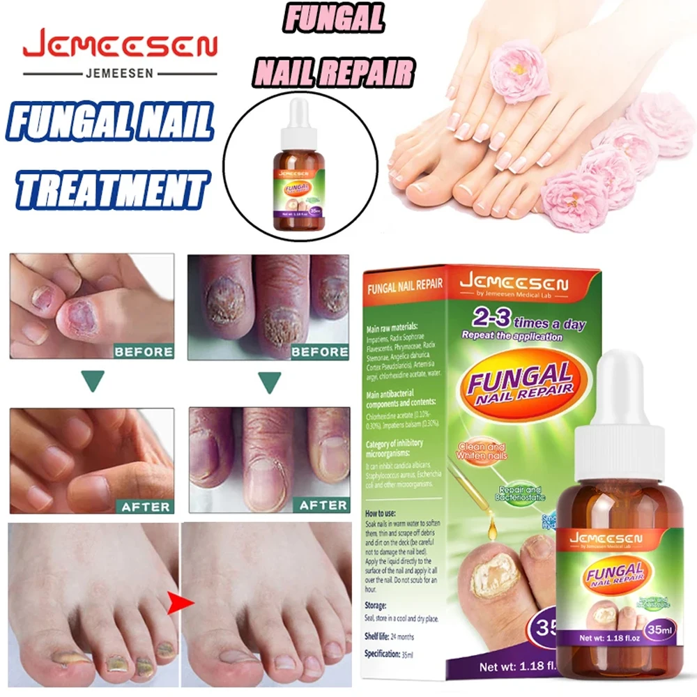 

Jemeesen Nail Fungus Treatment Serum To Get Rid Of Grey Nails Anti-Infection Toe Fungus Repair Gel Treatment ProductsJemeesen Fu