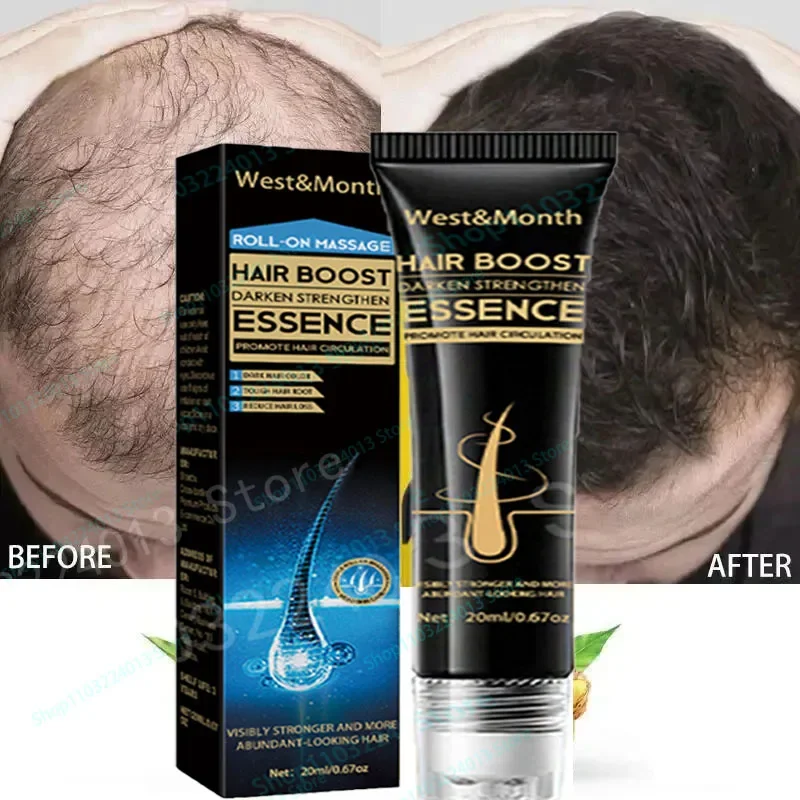 Natural Hair Growth Hair Roots Fast Grow Anti Hair Loss Serum Liquid Scalp Damaged Treatment Repair Beauty Health
Natural Hair Growth Hair Roots Fast Grow Anti Hair Loss Serum Liquid Scalp Damaged Treatment Repair Beauty Health