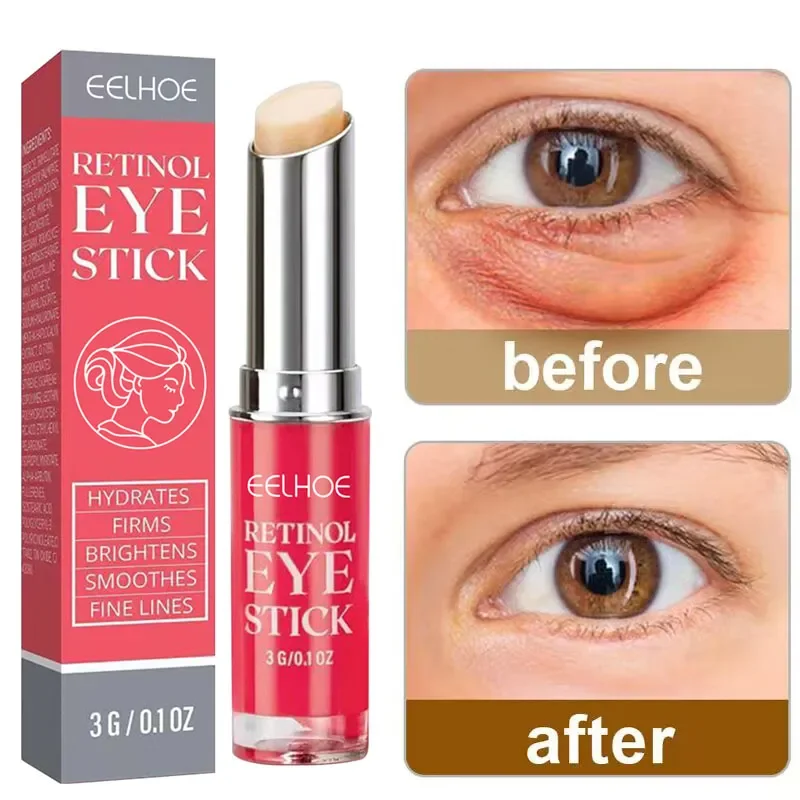 

Retinol Anti-Wrinkle Eye Cream Remove Eyes Bags Dark Circles Anti Puffiness Fade Fine Lines Firm Moisturizing Brighten Skin Care