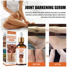 50ml Dark Kunckle Whitening Serum Improve Dullness Even Skin Tone Joints Elbows Knees Strong Whitening Serum
50ml Dark Kunckle Whitening Serum Improve Dullness Even Skin Tone Joints Elbows Knees Strong Whitening Serum