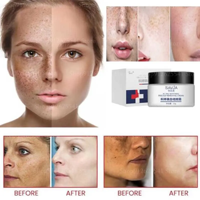 Niacinamide Facial Day Cream for Whitening Brightening Effectively Removes Dark Spot Age Spots Chloasma Spots Freckles
Niacinamide Facial Day Cream for Whitening Brightening Effectively Removes Dark Spot Age Spots Chloasma Spots Freckles