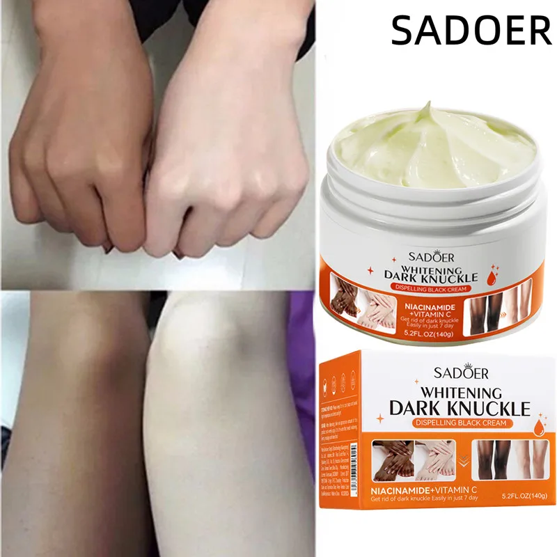 

Effective Body Whitening Cream Face Underarm Armpit Ankles Elbow Knee Legs Private Parts Dull Brightening Moisturizing Skin Care