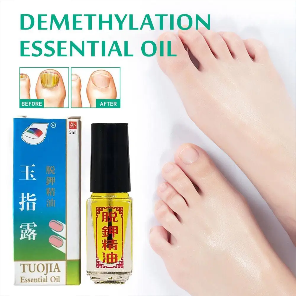 3 Days Effect Really work Nail Treatment Removal of onychomycosis Paronychia Anti oil Fungal Nail Infection Toe Nail Fungus oil
3 Days Effect Really work Nail Treatment Removal of onychomycosis Paronychia Anti oil Fungal Nail Infection Toe Nail Fungus oil