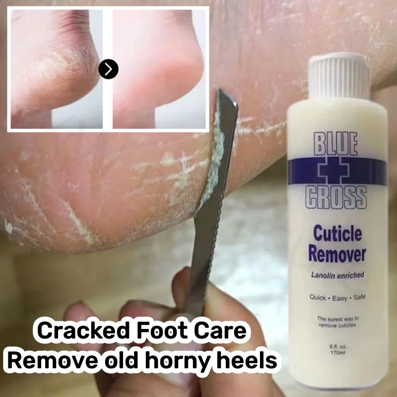 Cracked Foot Care Remove Dead Skin and Calluses Foot Film Pedicure Milk Heel Cracked Softening Moisturizing Cream Foot Beauty
Cracked Foot Care Remove Dead Skin and Calluses Foot Film Pedicure Milk Heel Cracked Softening Moisturizing Cream Foot Beauty