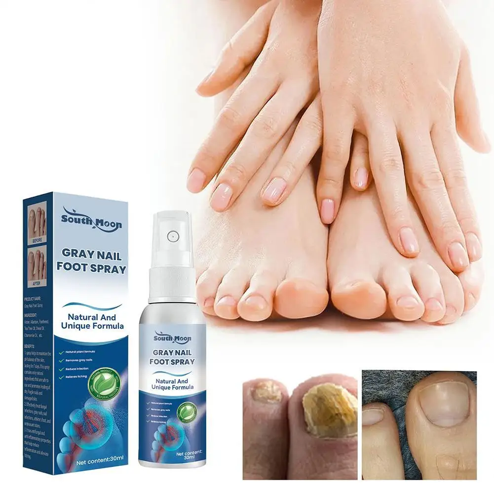 30ml Nail Spray Effective Anti-Fungal Feet Gray Nail Nails Nail Spray Hand Care Foot Soft Yellow Nails Repair Thickening In G5B5
30ml Nail Spray Effective Anti-Fungal Feet Gray Nail Nails Nail Spray Hand Care Foot Soft Yellow Nails Repair Thickening In G5B5