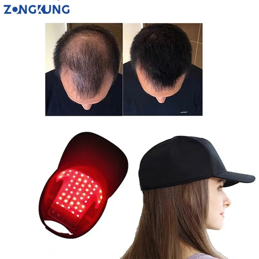 ZONGKUNG LED Red Light Therapy Cap Hair Growth Hat Red Infrared Light Therapy Device for Hair Loss Treatment USB Charging
ZONGKUNG LED Red Light Therapy Cap Hair Growth Hat Red Infrared Light Therapy Device for Hair Loss Treatment USB Charging