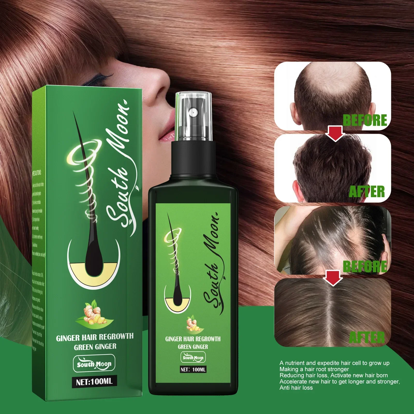 

Sdotter New Ginger Hair Growth Spray Serum For Anti Hair Loss Essential Oil Products Fast Treatment Prevent Hair Thinning Dry Fr