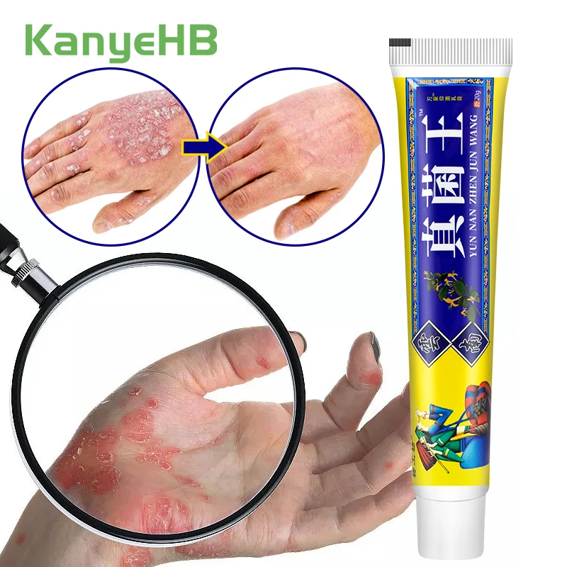 1Pcs Psoriasis Ointment Genitals Eczema Antibacterial Herbal Medicine Cream Anti-itch Treat Dermatitis Urticaria Unguent S099
1Pcs Psoriasis Ointment Genitals Eczema Antibacterial Herbal Medicine Cream Anti-itch Treat Dermatitis Urticaria Unguent S099