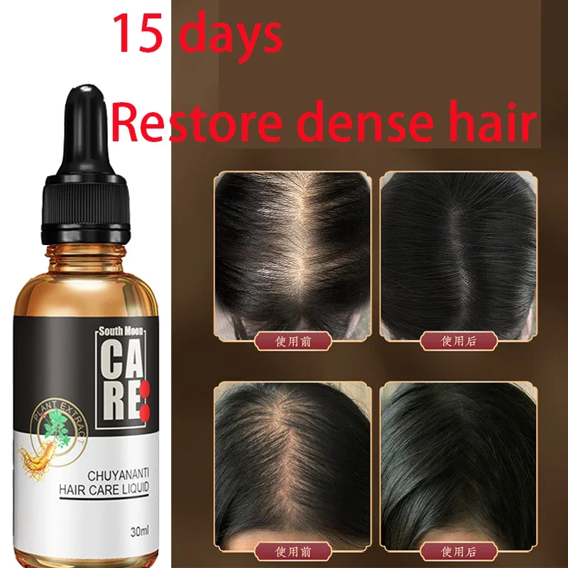 Hair growth solution for preventing hair loss, fixing and densifying hair, magical hairline, hair growth and growth
Hair growth solution for preventing hair loss, fixing and densifying hair, magical hairline, hair growth and growth