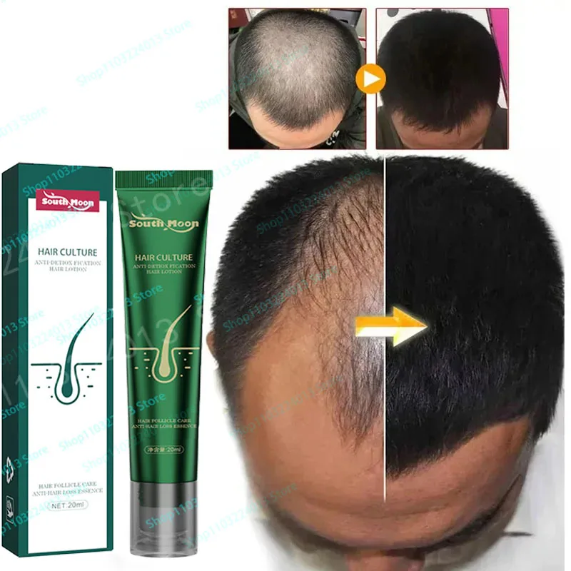 Strong Effect Hair Growth Products Ginger Essential Oil 2 Week Treat Hair Loss Scalp Repair Nourish Hair Roots Regrowth
Strong Effect Hair Growth Products Ginger Essential Oil 2 Week Treat Hair Loss Scalp Repair Nourish Hair Roots Regrowth