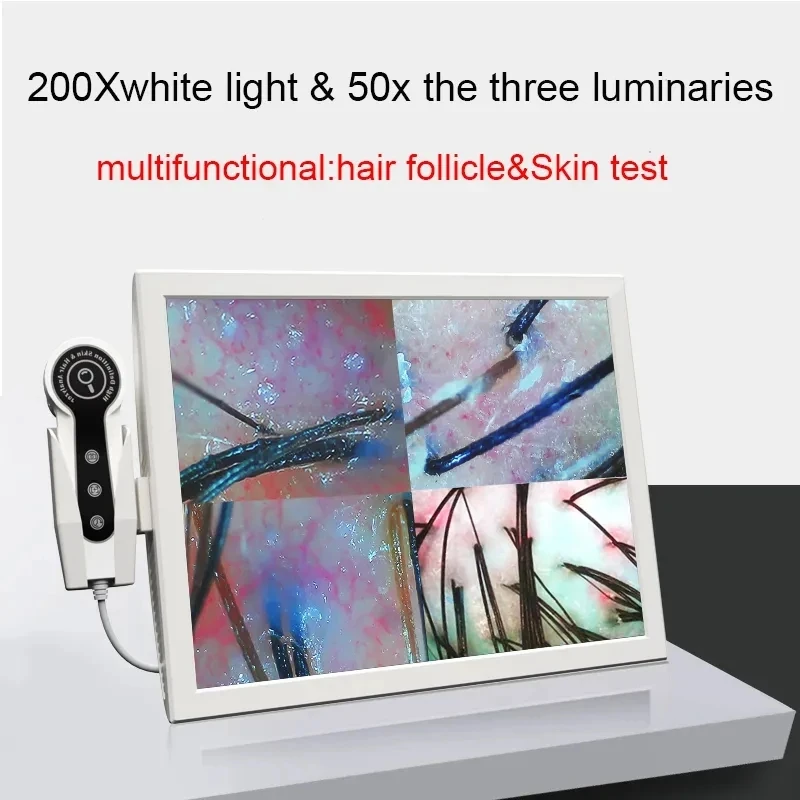 2024 HD Digital Skin Analyzer Professional Hair Scalp Camera Detector Hair Follicle Oil Moisture Test Device 15inch
2024 HD Digital Skin Analyzer Professional Hair Scalp Camera Detector Hair Follicle Oil Moisture Test Device 15inch