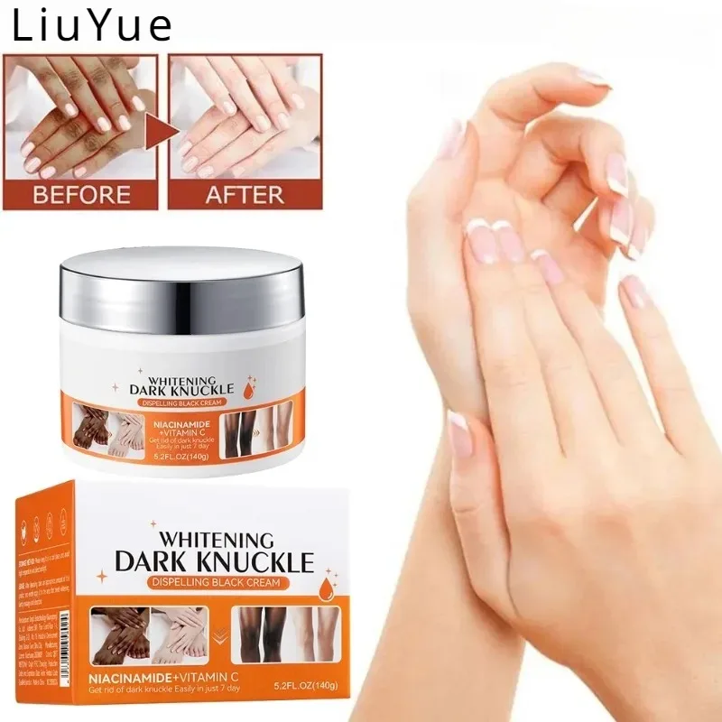 Dark Joint Brightening Cream Pigmentation Improvement Elbow Knee Moisturizing Skin Moisture Lightening Dull Skin Bleaching Cream
Dark Joint Brightening Cream Pigmentation Improvement Elbow Knee Moisturizing Skin Moisture Lightening Dull Skin Bleaching Cream