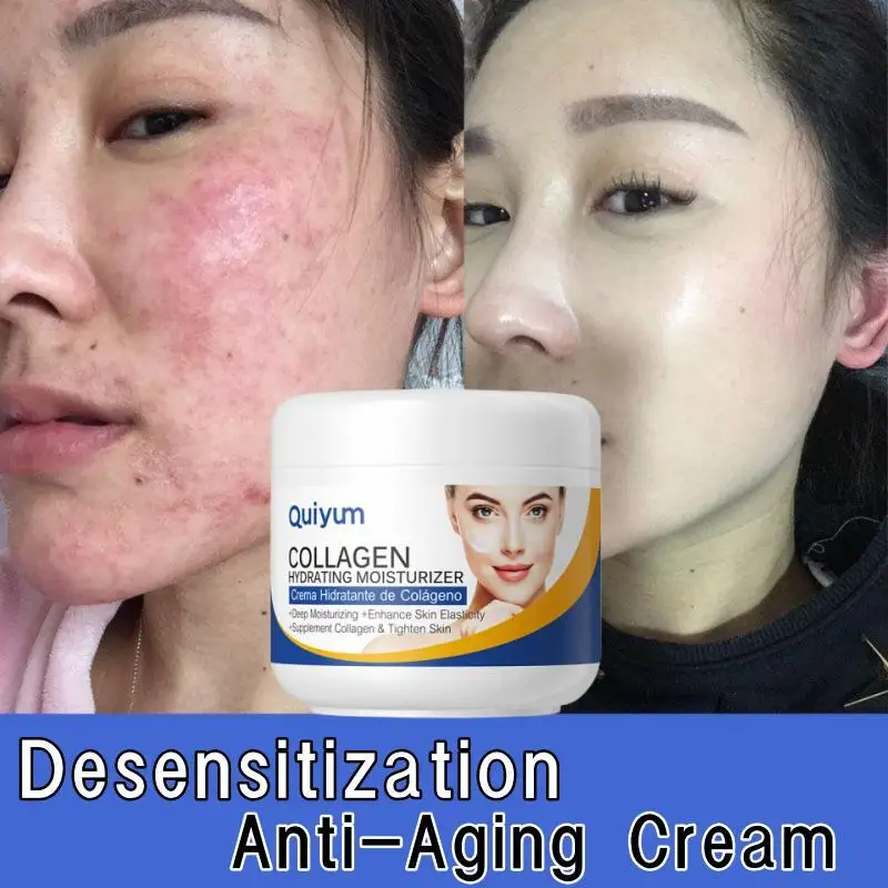 Instant Facial Redness Repair Cream Soothing Red Blood Rosacea Treatment Improve Sensitive Skin Moisturizer Skin Care Cosmetics
Instant Facial Redness Repair Cream Soothing Red Blood Rosacea Treatment Improve Sensitive Skin Moisturizer Skin Care Cosmetics