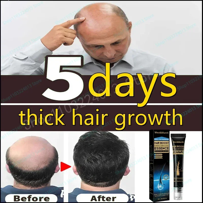

Sdotter Новинка быстрое рост волос для мужчин и женщин масло для роста волос лечение против выпадения волос лечение кожи головы продукты для красоты здоровья