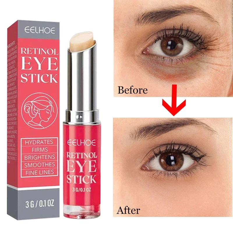 Retinol Remove Dark Circles Eye Cream Whitening Moisturizing Brighten Skin Care Anti Wrinkle Anti Aging Eye Bags Lifting Firming
Retinol Remove Dark Circles Eye Cream Whitening Moisturizing Brighten Skin Care Anti Wrinkle Anti Aging Eye Bags Lifting Firming