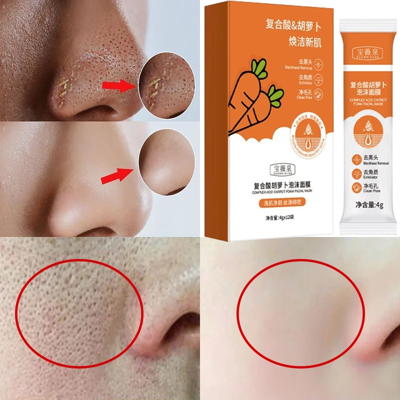 

Face Cleaning Bubble Mask Remove Blackhead Oil Control Pimple Shrinking Pore Mask Brighten Whitening Cleansing Face Skin Care