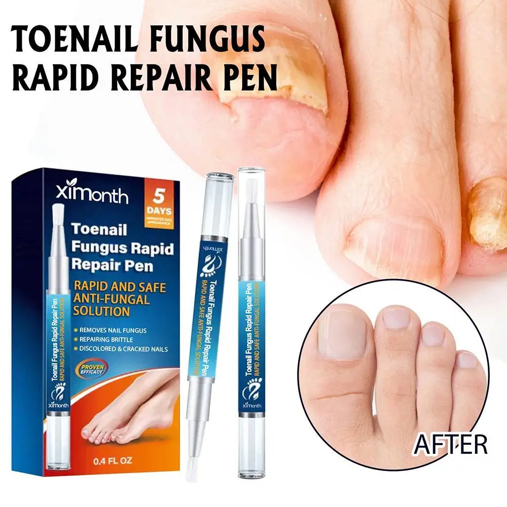 4pcs Fungi Nail Toenails Nail Repair Pen Anti Care Repair Serum Painless Nail Health For Thicked Broken Discolored Nails
4pcs Fungi Nail Toenails Nail Repair Pen Anti Care Repair Serum Painless Nail Health For Thicked Broken Discolored Nails