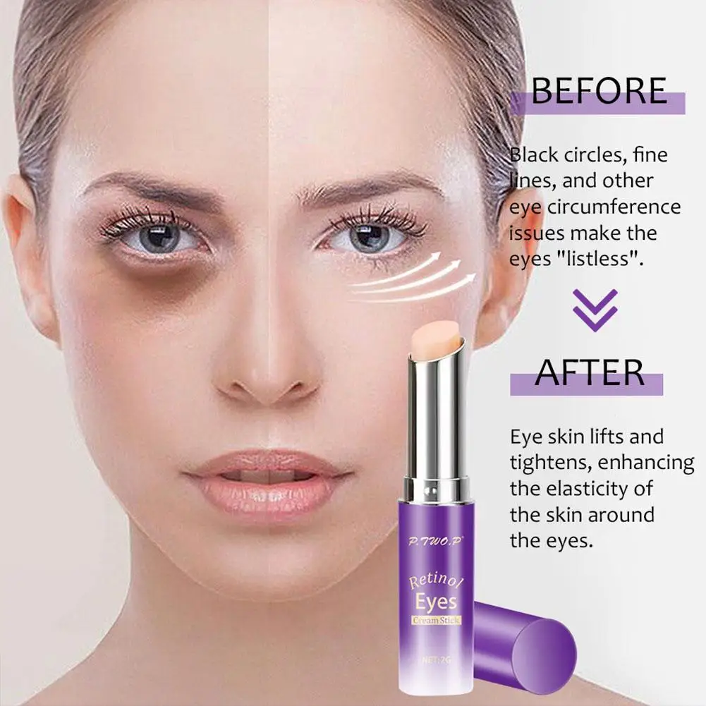 Retinol Eye Cream Stick Dark Circles Eye Bags Remover Care Anti-puffiness Anti-wrinkle Skin Moisturizing Lines Eye Fine Red H9o2
Retinol Eye Cream Stick Dark Circles Eye Bags Remover Care Anti-puffiness Anti-wrinkle Skin Moisturizing Lines Eye Fine Red H9o2
