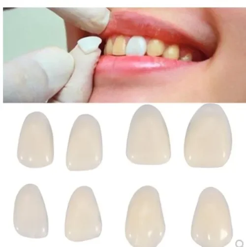 

Sdotter New 60PC A1 A2 color Dental Ultra-Thin Whitening Veneers Resin Porcelain Materials Temporary Teeth Upper Anterior White