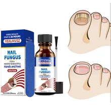 Foot Nail Fungus Treatment Serum Removal Onychomycosis Paronychia Anti-Fungal Nail Infection Gel Repair Nourish Care Essence 20g
Foot Nail Fungus Treatment Serum Removal Onychomycosis Paronychia Anti-Fungal Nail Infection Gel Repair Nourish Care Essence 20g