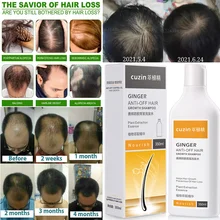 Extract Plant Essence Anti-hair Loss Shampoo Ginger Thick Fluffy Seborrheic Pregnant Women Anti-hair Loss Hair Shampoo
Extract Plant Essence Anti-hair Loss Shampoo Ginger Thick Fluffy Seborrheic Pregnant Women Anti-hair Loss Hair Shampoo