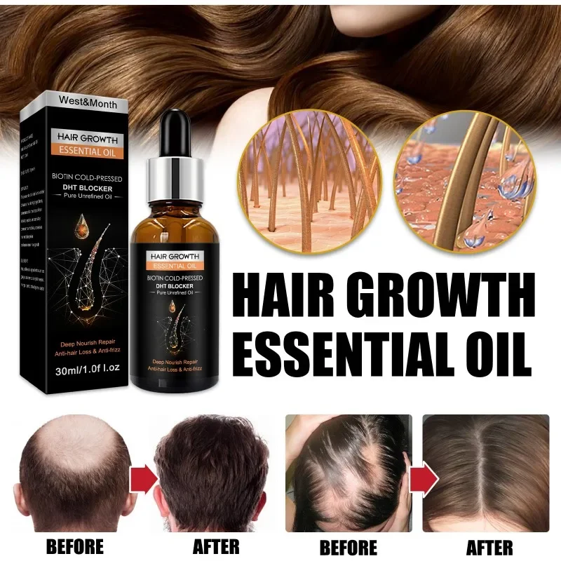 

30ml Hair Growth Essential Oil Biotin Cold-pressed Dht Blocker And Shampoo Anti-hair Loss Conditioner Accessories Prevent Loss