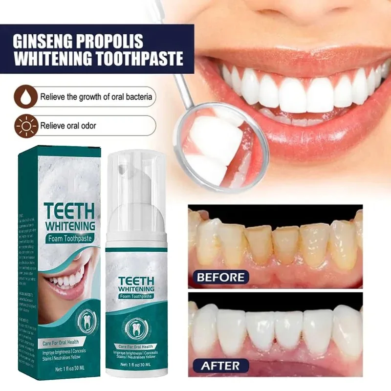 

Whitening Fresh Breath Brightening Purple Toothpaste Remove Stain Reduce Yellowing Care for Teeth Gums Oral Tooth Decay Repair