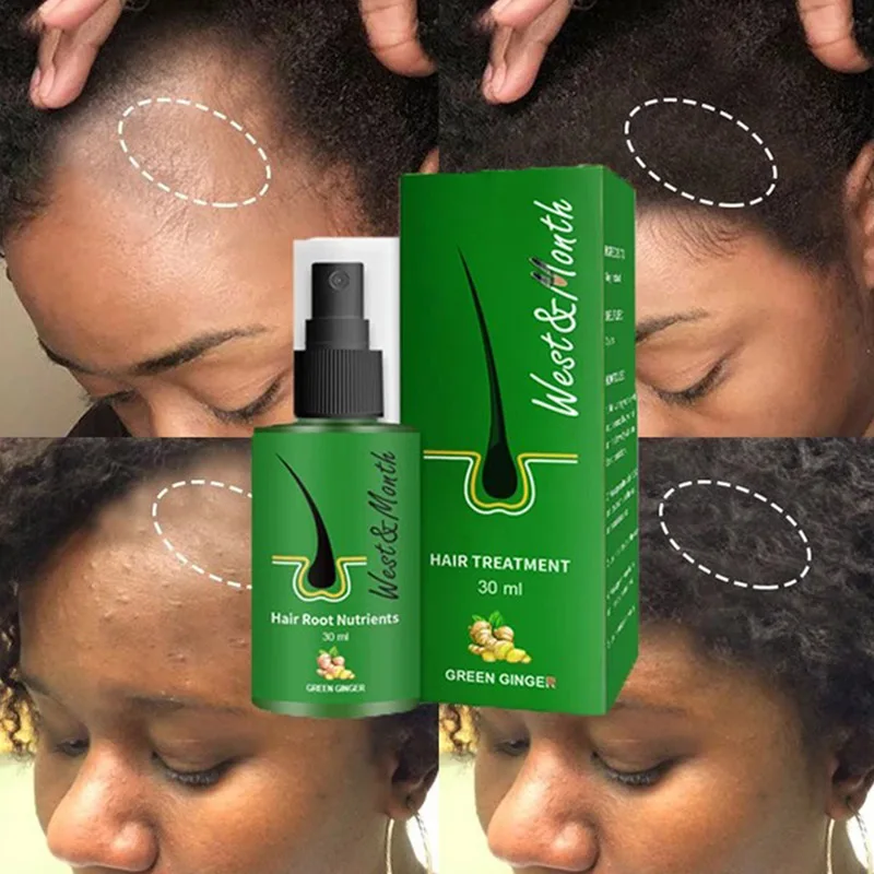 30ml Ginger Hair Growth Spray Essential Oils Hair Loss Treatment Fast Grow Prevent Hair Dry Frizzy Damaged Thinning Repair Care
30ml Ginger Hair Growth Spray Essential Oils Hair Loss Treatment Fast Grow Prevent Hair Dry Frizzy Damaged Thinning Repair Care