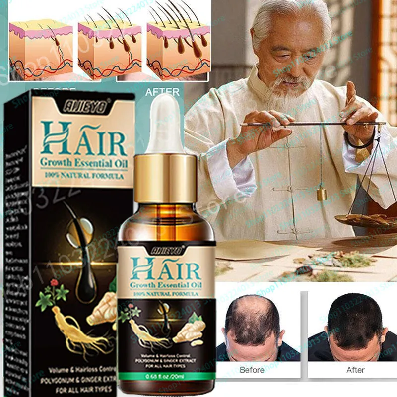 

Biotin Fast Oil Hair care Regrowth Serum Hair Thinning Treatment Liquid Anti-Hair Loss For Women Amp Men hair products