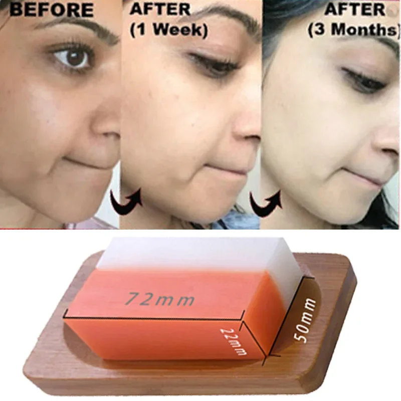 Kojic Acid Glutathion Skin Whitening Soap Dark Black Skin Lightening Soap Kojic Acid Glycerin Brighten Face Body Skin Bleaching
Kojic Acid Glutathion Skin Whitening Soap Dark Black Skin Lightening Soap Kojic Acid Glycerin Brighten Face Body Skin Bleaching