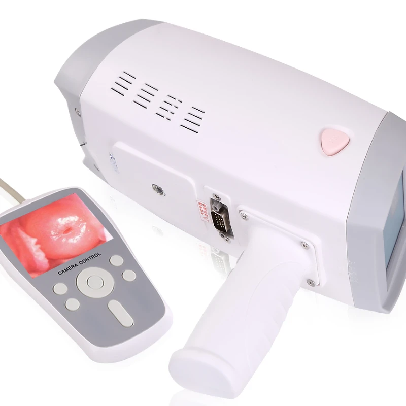 MY-F005 portable Handheld Gynecology Colposcopy system digital electronic video for women for gynecology
MY-F005 portable Handheld Gynecology Colposcopy system digital electronic video for women for gynecology