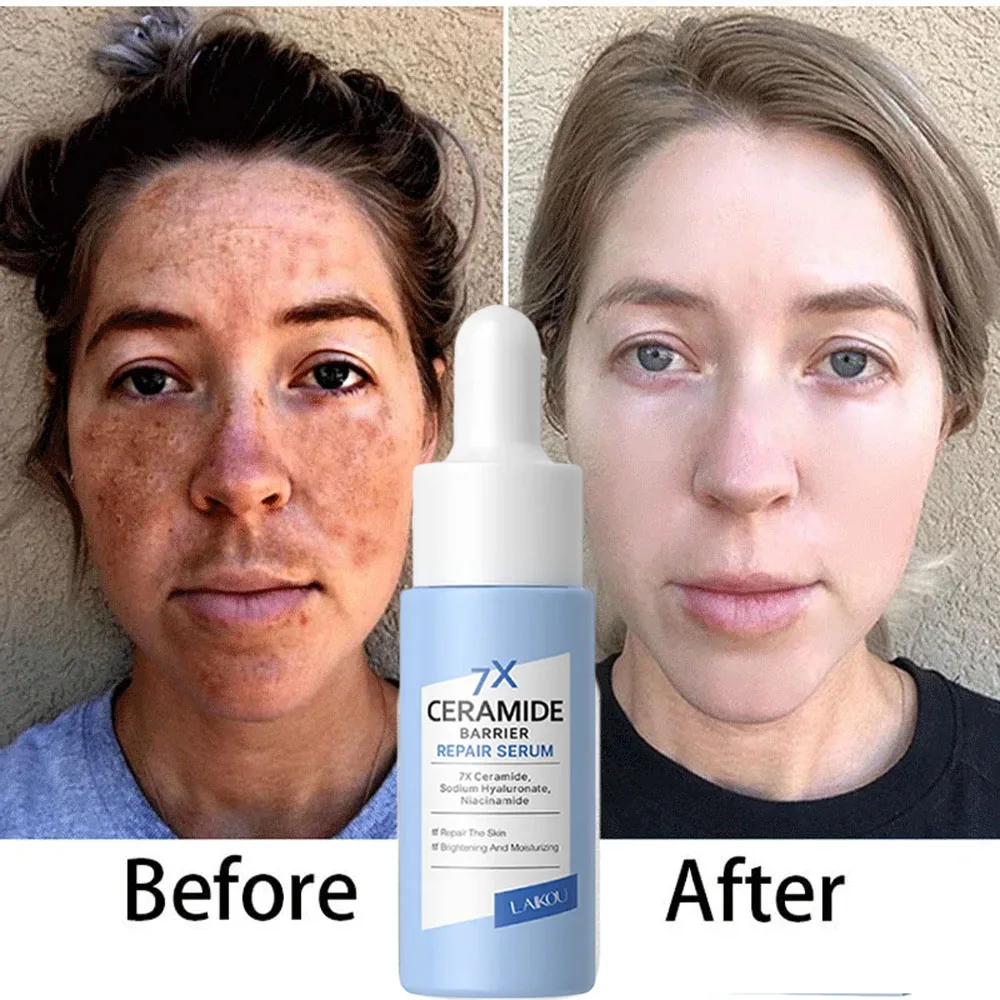 Niacinamide Face Serum Powerful Removal Melasma Chloasma Black Freckle Whitening Moisturizing Repair Skin Care Products Essence
Niacinamide Face Serum Powerful Removal Melasma Chloasma Black Freckle Whitening Moisturizing Repair Skin Care Products Essence